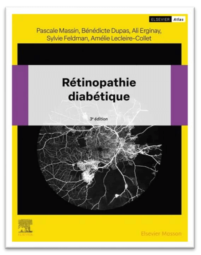 Livre Rétinopathie Diabétique - Amélie Lecleire Collet